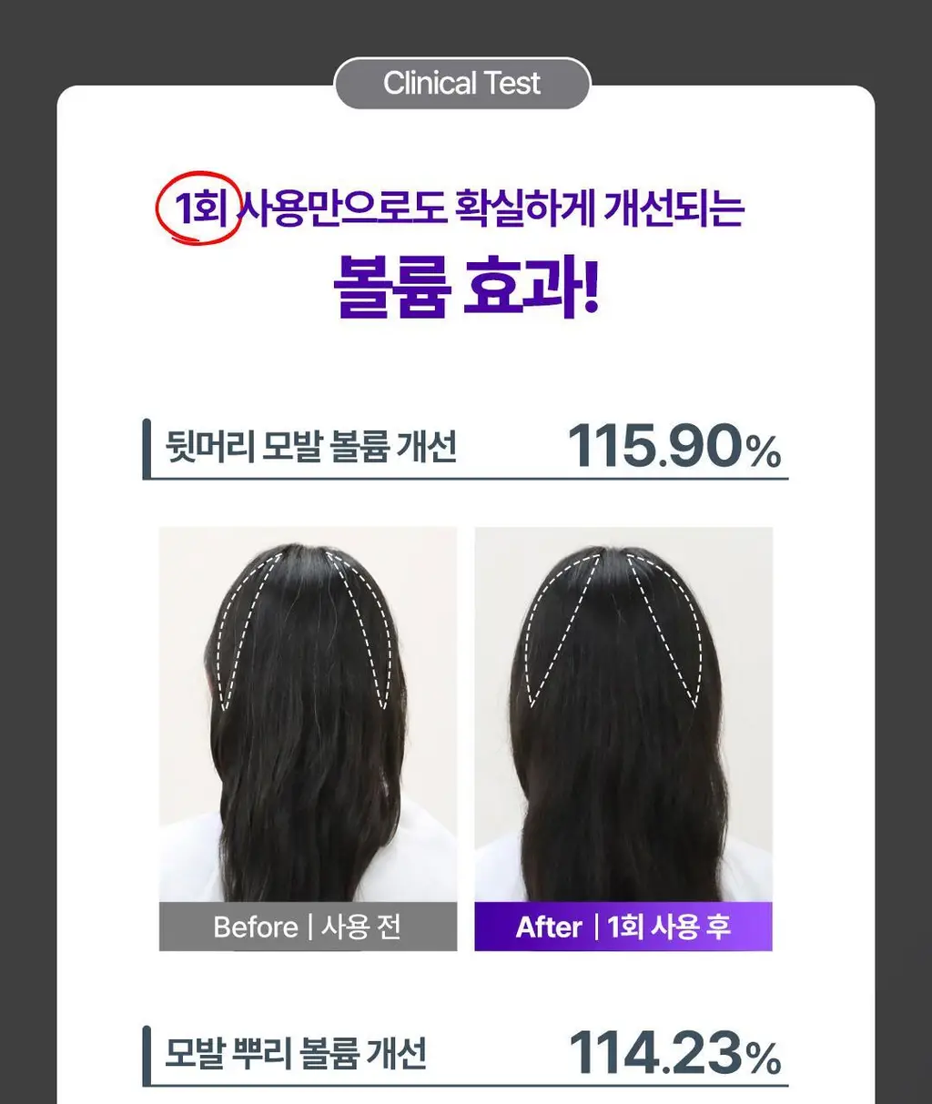 [No.1 헤어/두피 디바이스] 레스노베 하이퍼샷(베이지/핑크) 상세페이지 19